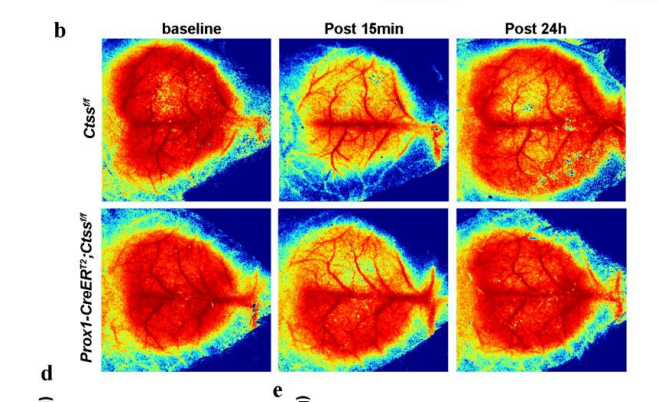 小鼠脑部血流图 小鼠脑部血流图